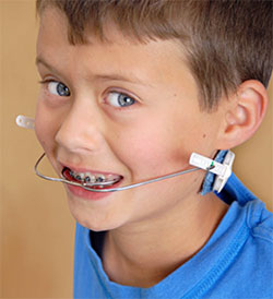 This is the image for the news article titled Orthodontic Headgear